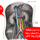 Illustration for article titled Inkjet Cartridges To Save Your Kidneys